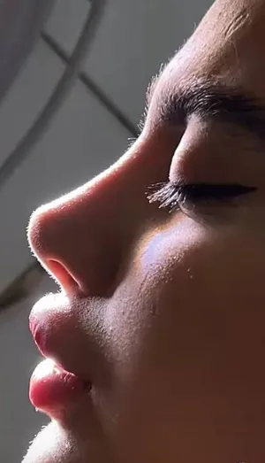 عملية تجميل الأنف في إيران طبيب تجميل متخصص