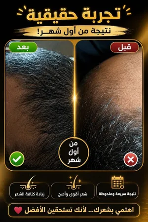 البخاخ العجيب : الحل الثوري والاقوى بديل زراعة الشعر الكثافة وفراغات الشعر !