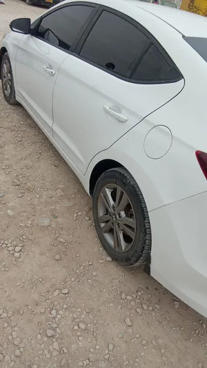 النترا 2017