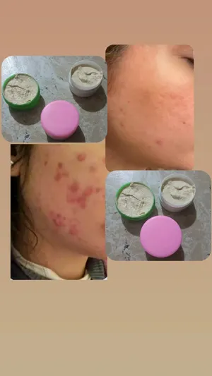 خلطه تصفيت بشرع مضمونه ميه بل ميه مواد عشبيه سعار 7من قير التوصيل ول توصيل 8