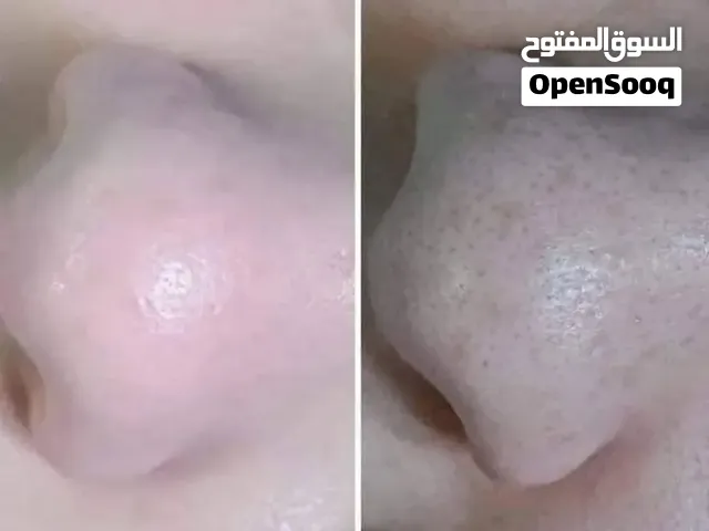 جهاز إزالة الرؤوس السوداء جديد استخدام سهل