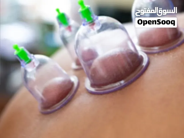 حجامة إسلامية والإصابات