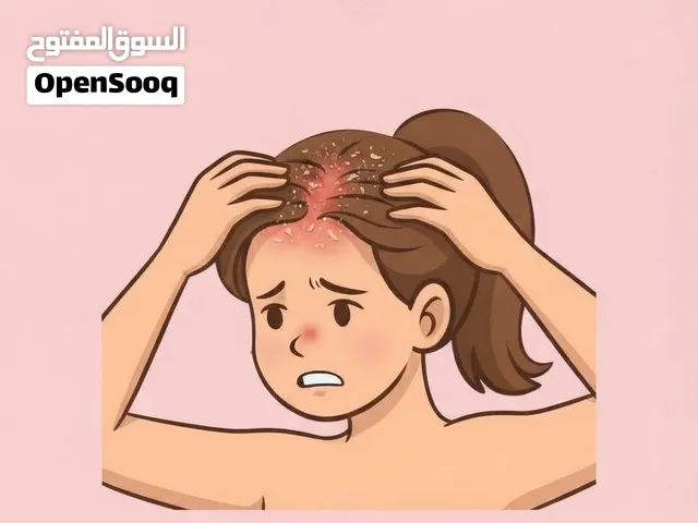 قشرة حكة للشعر  الحل== مرطب كوتا للشعر + سيروم مرطب + صابونة للانبات والقشرة