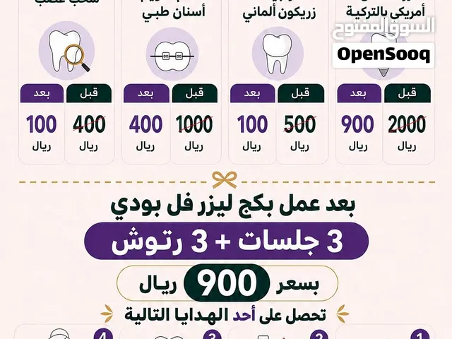 زراعة الأسنان بسعر 900 ريال