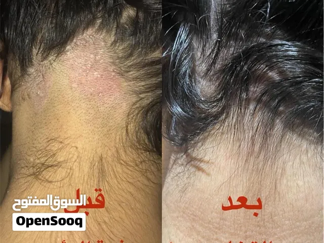 لو شعرك يتساقط وتتعبين من التجارب هذا الروتين أنقذ شعري