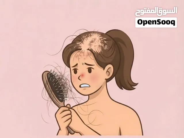 تساقط قوي وفراغات  الحل== البكج الهندي