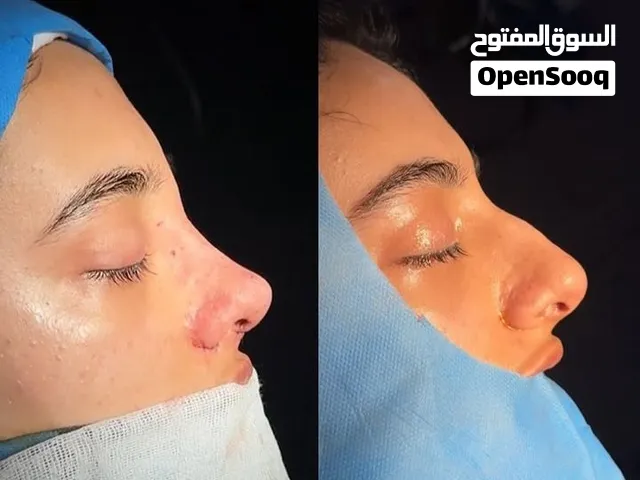 تجميل ايران