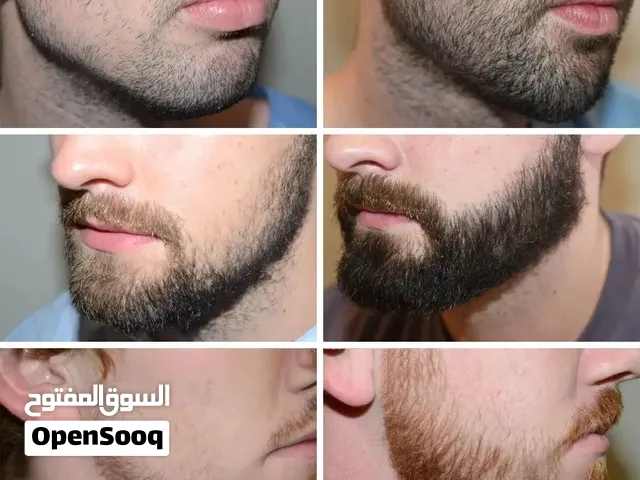 نمو اللحية والشارب