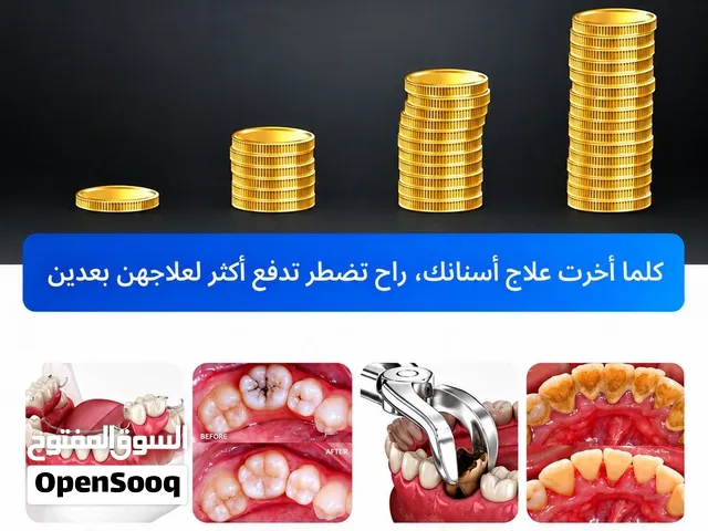 علاج الأسنان مجاناً بالكامل