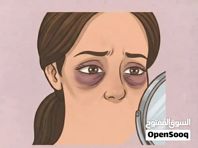انتفاخ + هالات قوية  الحل== ريتنول