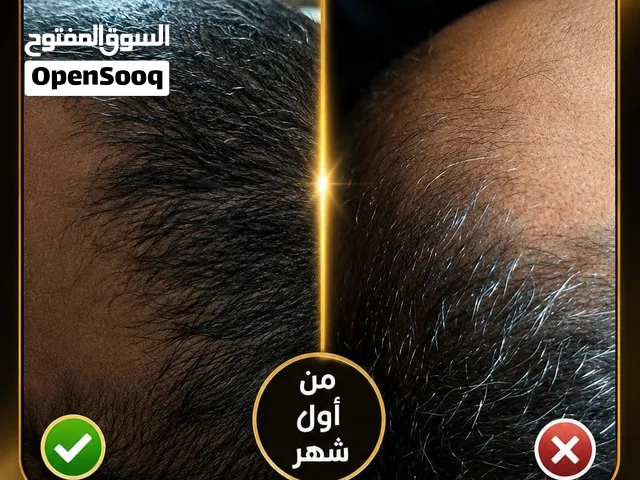 البخاخ العجيب : الحل الثوري والاقوى بديل زراعة الشعر الكثافة وفراغات الشعر !