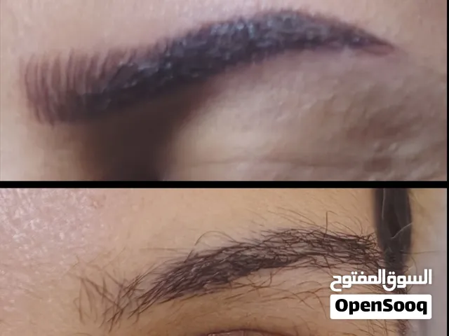 مايكرو بليدنج وتوريد وديرما بن